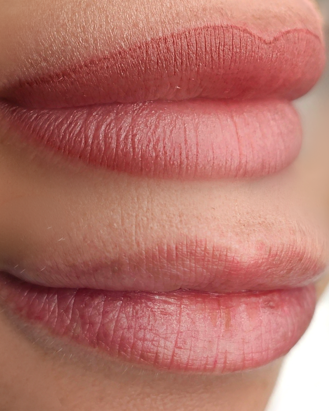 Labbra prima e dopo il trattamento Acquarelle Lips
