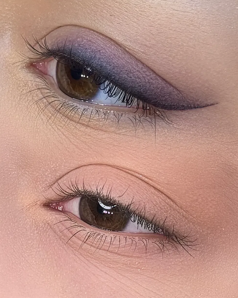 Eyeliner permanente e infoltimento della rima ciliare
