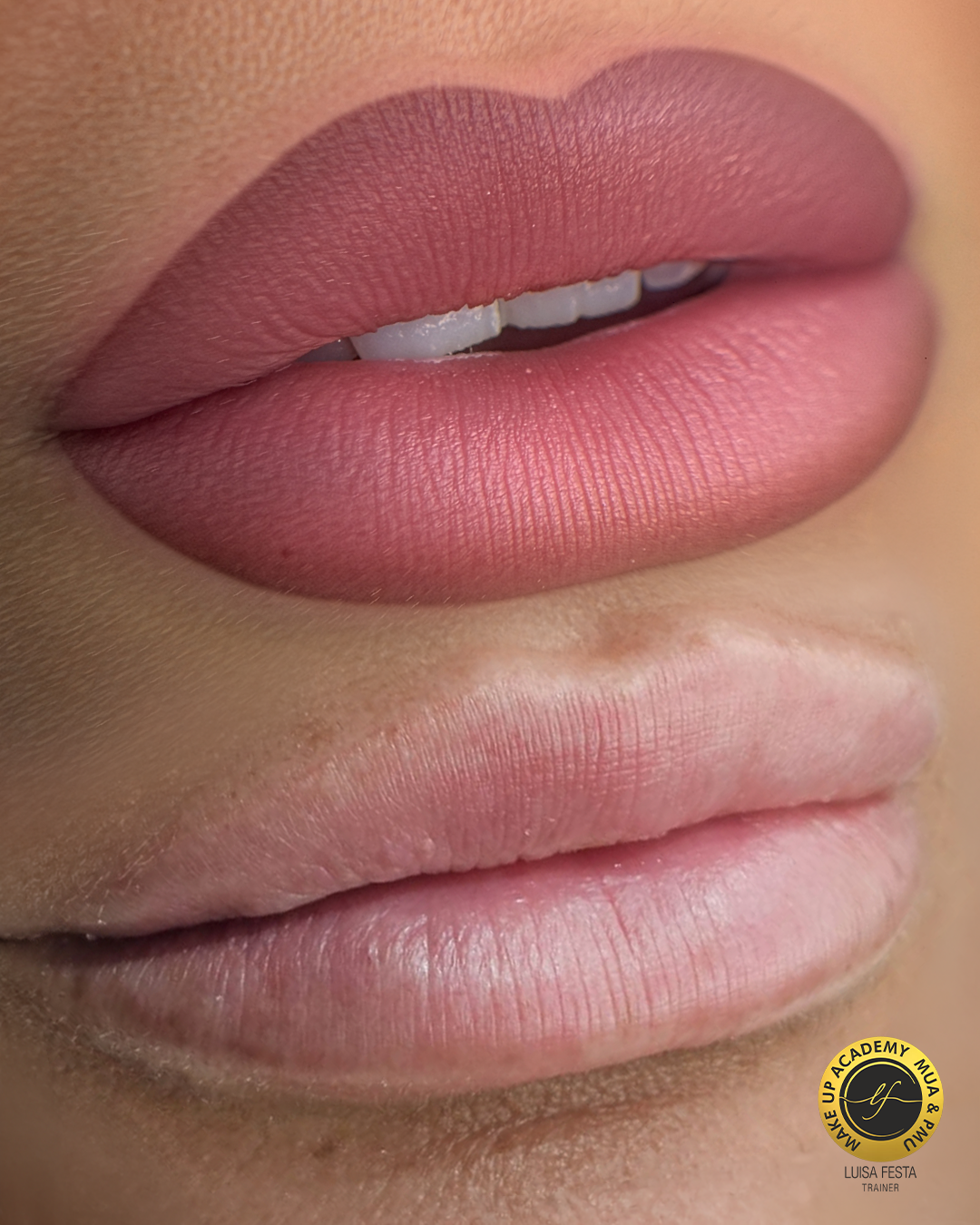 Risultato del trattamento Acquarelle Lips, labbra prima e dopo