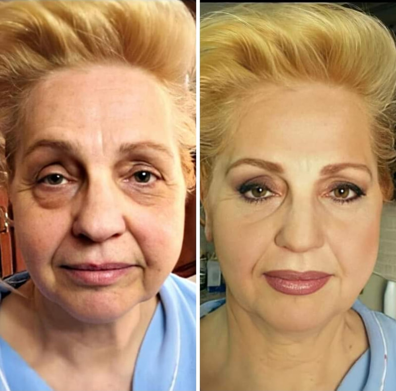 Anti-Age · Look 4